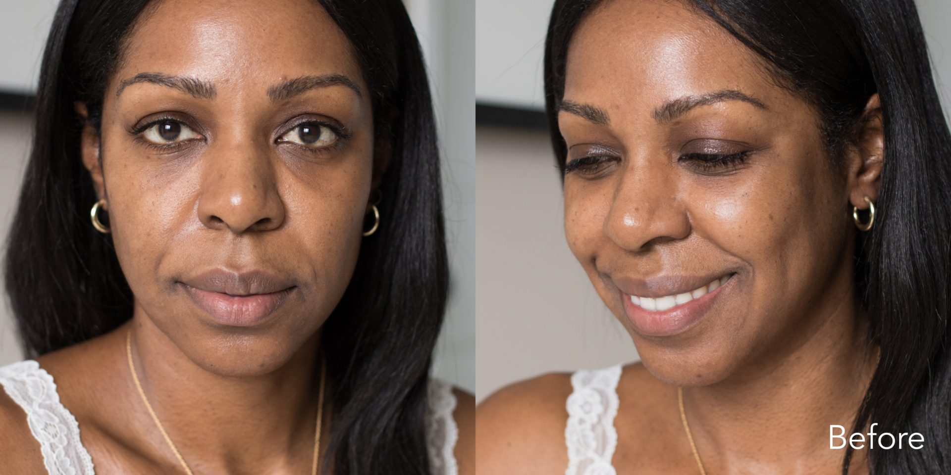 Why You Need to Start Using Retinol Now Style Domination