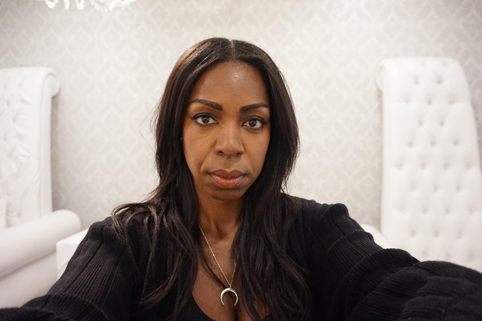 I Got Dermal Fillers And This is What Happened - Belotero at Oxygen MediSpa | Style Domination by Dominique Baker